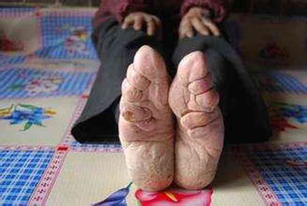 历史上中国女人裹小脚是从什么时候开始的?三寸金莲的来历