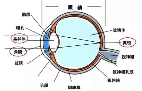 什么是指数近视（近视眼可以分为哪几类）