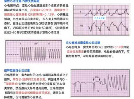 电波系到底是什么？揭秘电波系背后的含义和误解