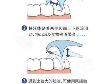 超详细牙线使用步骤：告别牙缝食物残渣