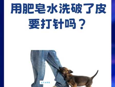 狗咬了多久过安全期 医生说要观察多少天